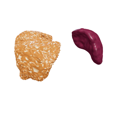 Karaciğer sirozu
