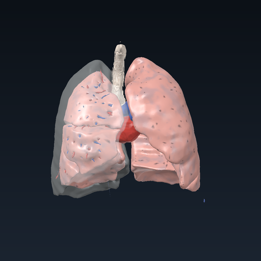 Pneumothorax