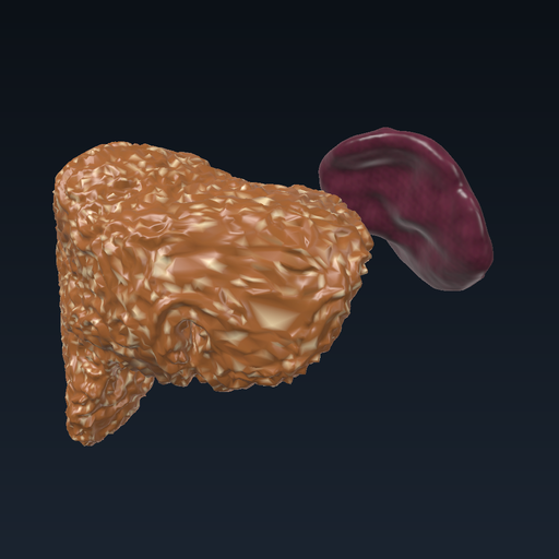 Liver cirrhosis
