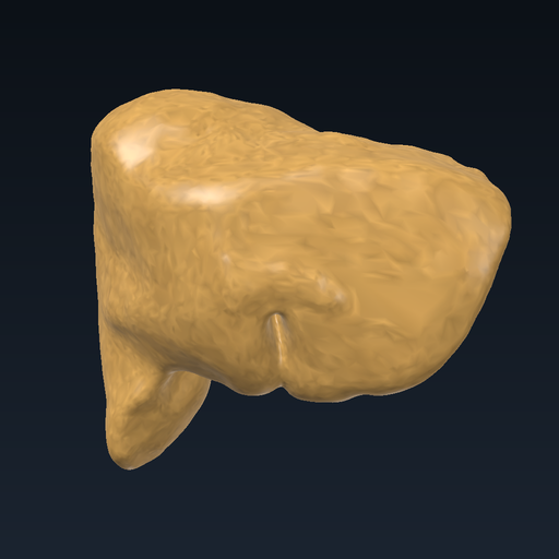 Fatty liver
