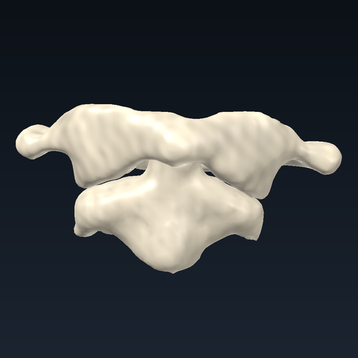 Atlas and axis (C1–C2)