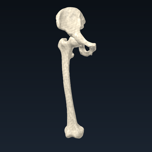 Hip bone and femur (right)