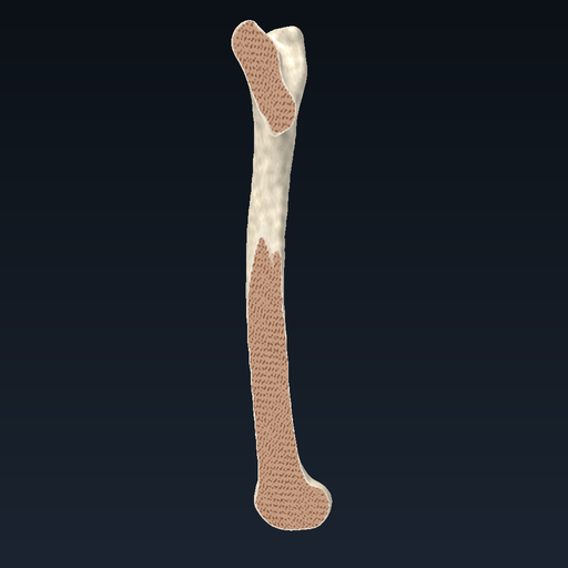 Femur – sagittal section