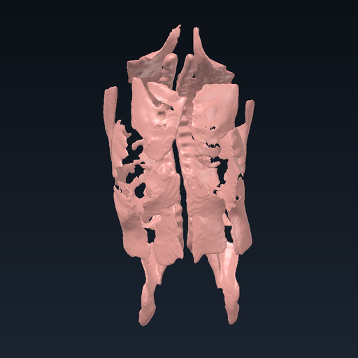 Trunk muscles: chest, abdominal wall and back