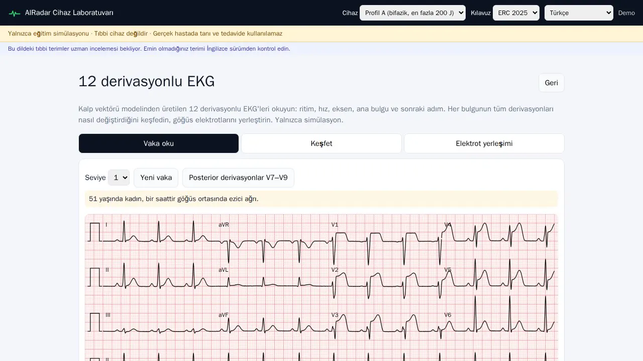 12-lead ECG case in the AIRADAR Device Lab